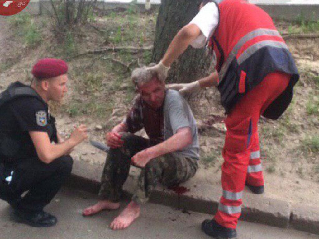 В Киеве два брата устроили кровавую драку (ФОТО)