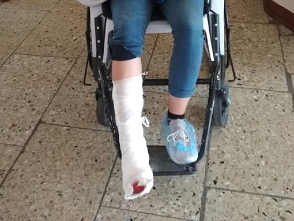 Два открытых перелома: В аэропорту «Жуляны» на девушку упал шкаф (ФОТО)