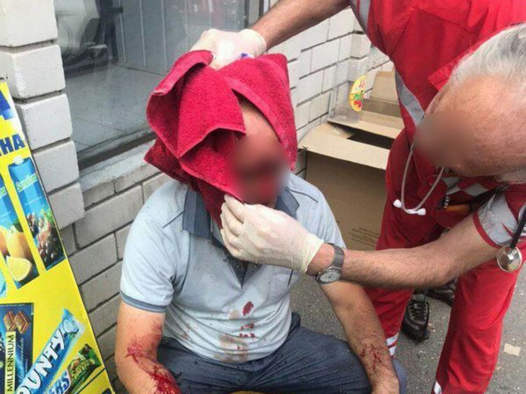 В Днепре мужчине в ходе спора прострелили голову (ФОТО)