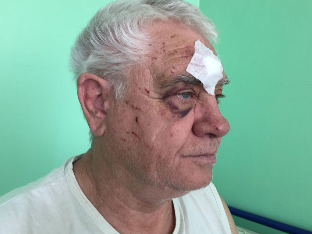 Мужчина ехал из онкодиспансера: В Харькове в трамвае полицейский жестоко избил пенсионера &#8212; СМИ (ФОТО)
