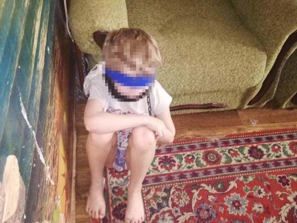 В Днепре многодетная женщина-опекун держала на цепи 8-летнего мальчика (ФОТО)