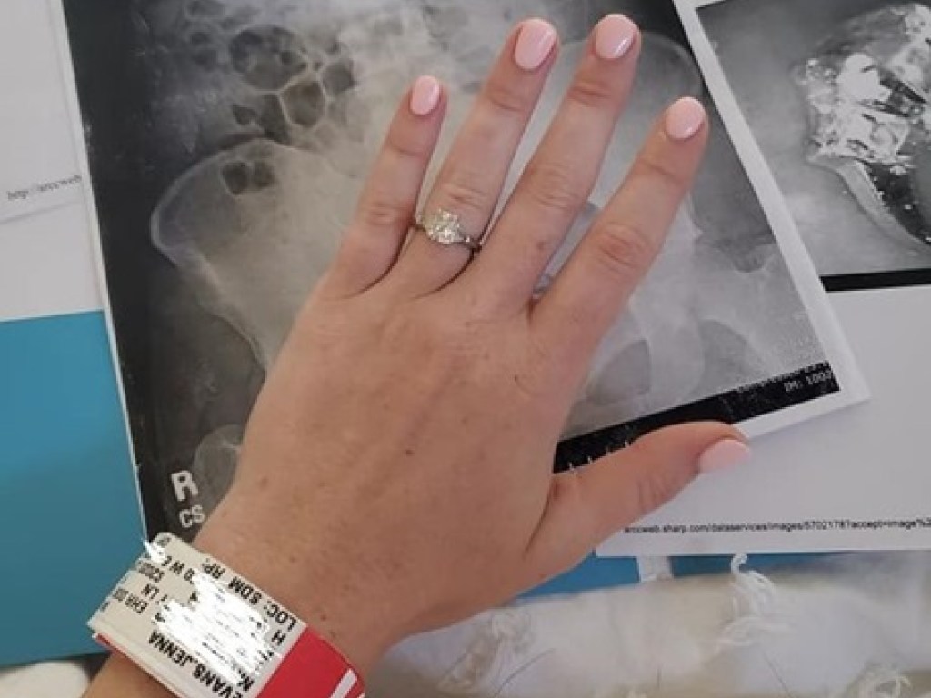 В США девушка проглотила кольцо с бриллиантом во время сна (ФОТО)