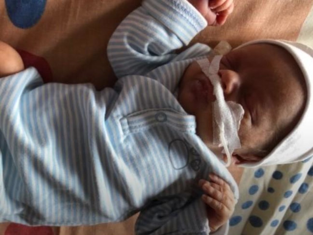 Во Львове у новорожденного удалили 2,5-килограммовую опухоль (ФОТО)