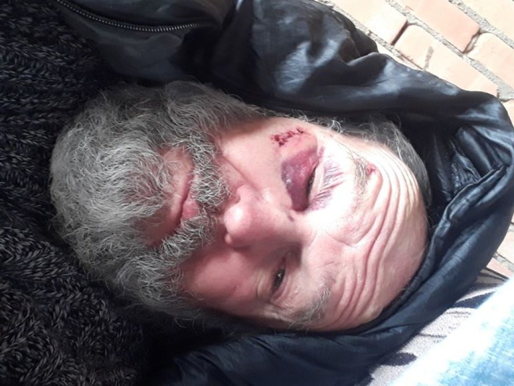 В Харькове жестко избили игумена: служитель церкви попал в неотложку (ФОТО)