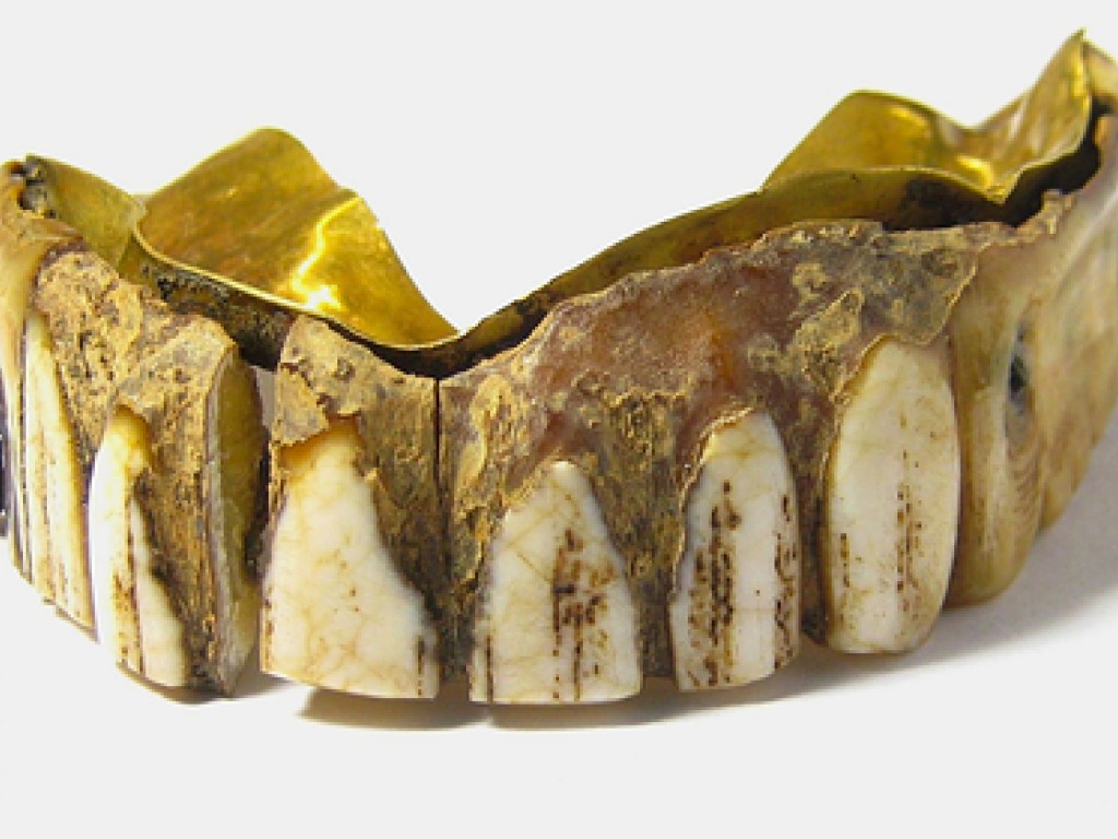 «200-летний раритет»: британец нашел древнюю вставную челюсть из золота и кости (ФОТО)