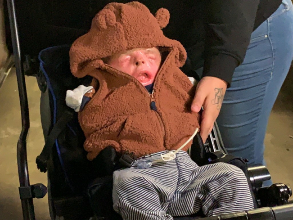 Малыша без кожи выписали из техасской больницы (ФОТО, ВИДЕО)