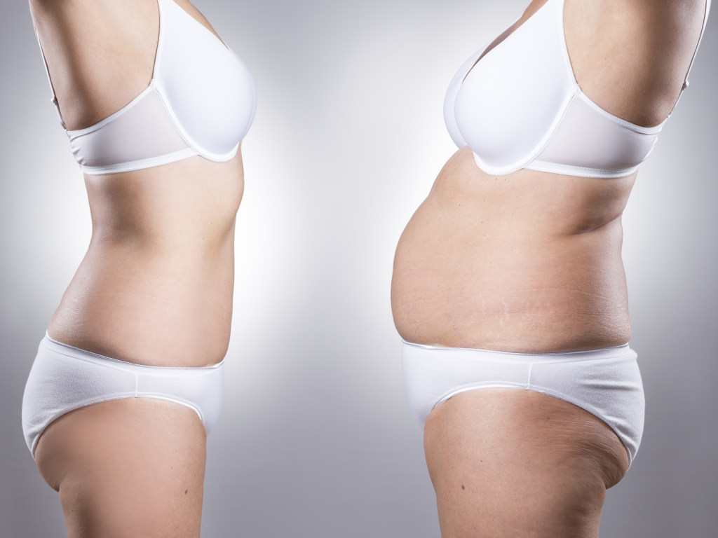 Врач: причиной лишнего веса могут стать хронические или наследственные болезни