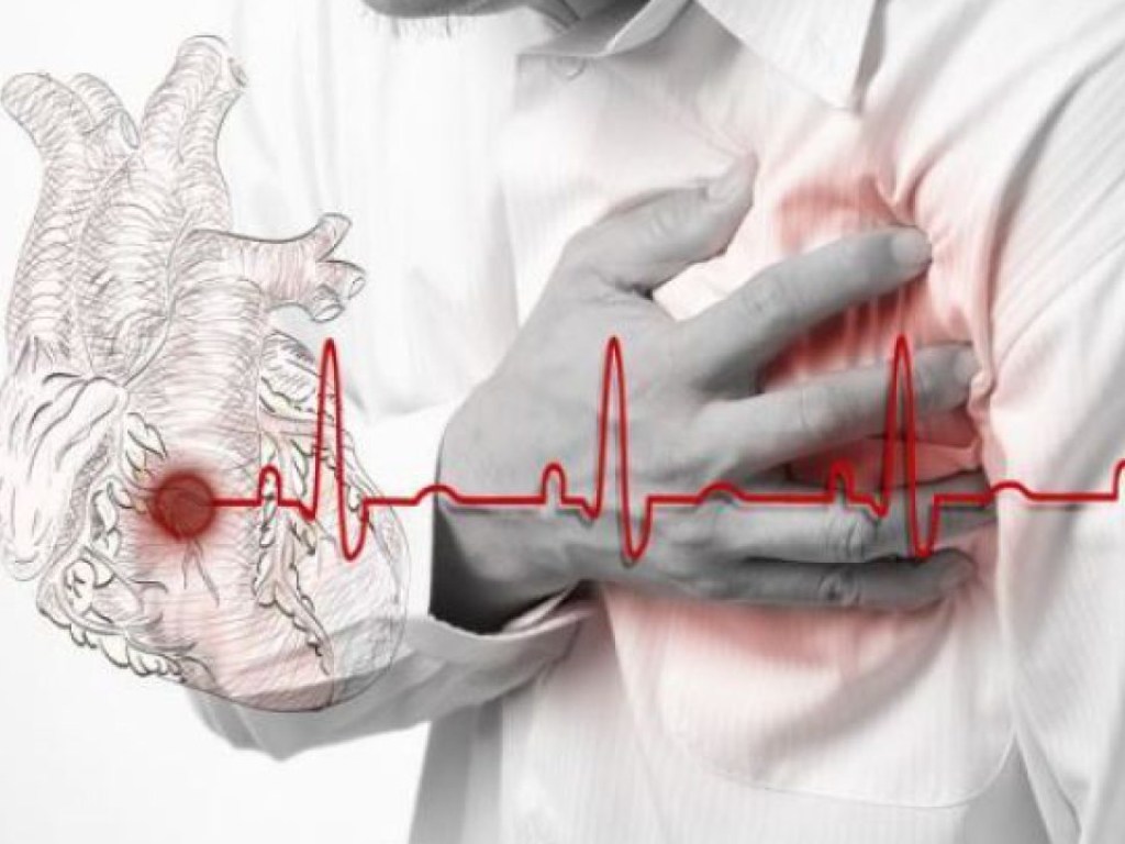 Немецкий кардиолог рассказал, как уберечься от инфаркта