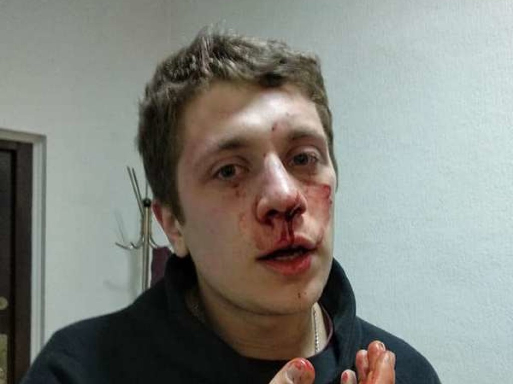Нападение на активистов в Днепре: двое парней обратились в больницу (ФОТО)