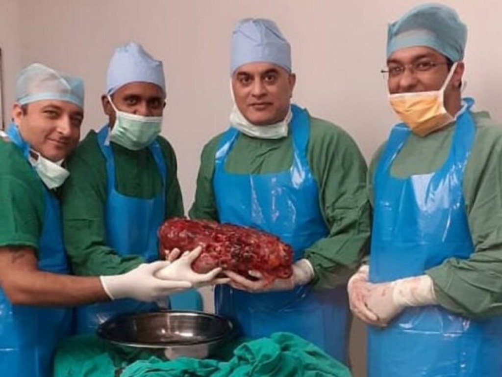 В Индии хирурги удалили почку весом почти 7,5 килограмма (ФОТО)