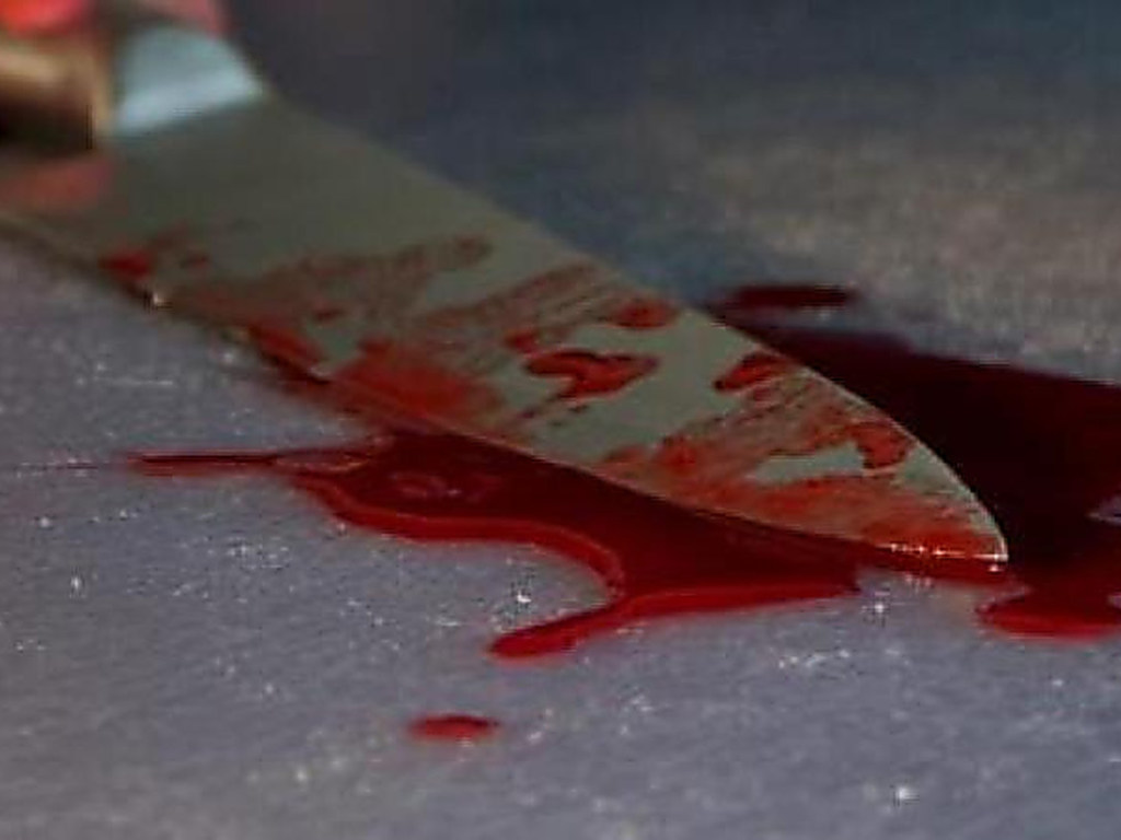 Жительница Одесской области ранила мать ножом и вызвала скорую (ФОТО)