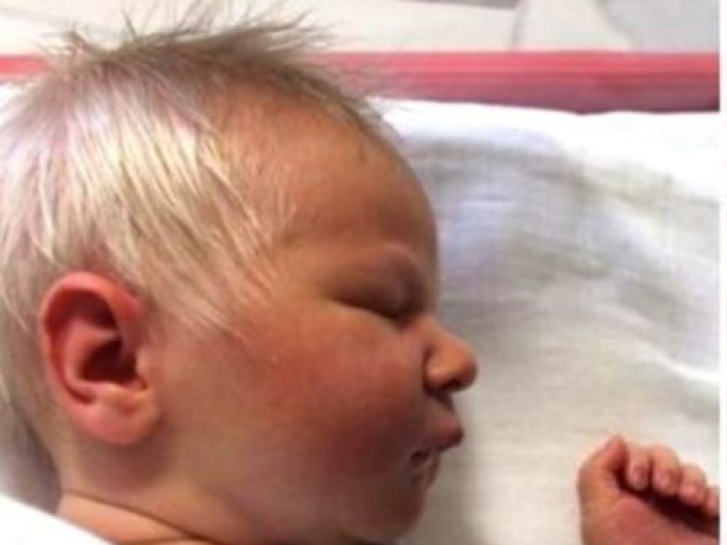 В Венгрии родился малыш с седыми волосами (ФОТО)