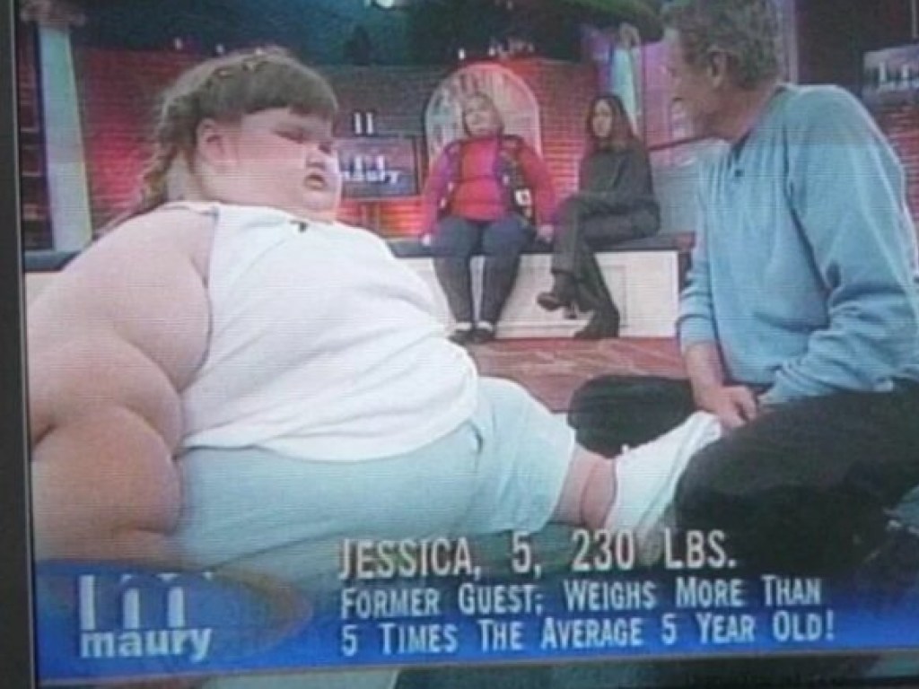 «Самая толстая в мире» девушка сбросила 145 килограмм за год и удивила весь мир (ФОТО)
