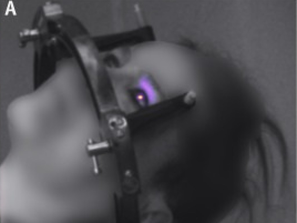 Ученым впервые удалось снять снимок феномена свечения человеческих глаз (ФОТО)