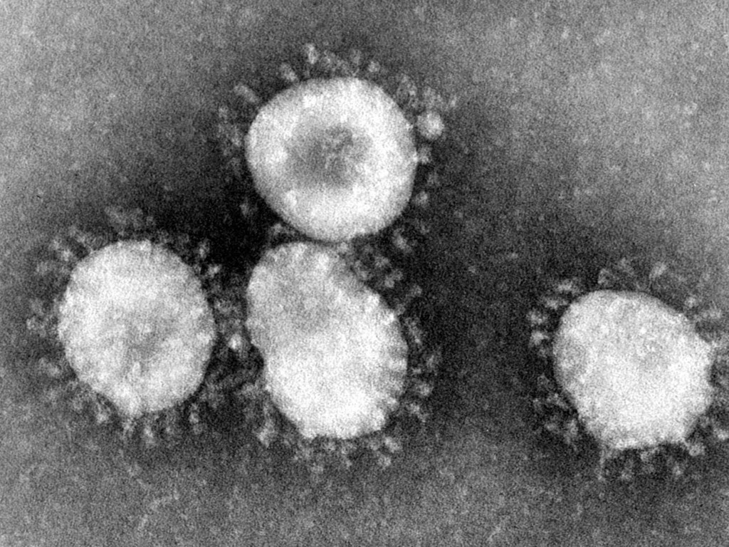 Ранее возникший в Китае смертельный вирус SARS впоследствии бесследно исчез – врач-инфекционист