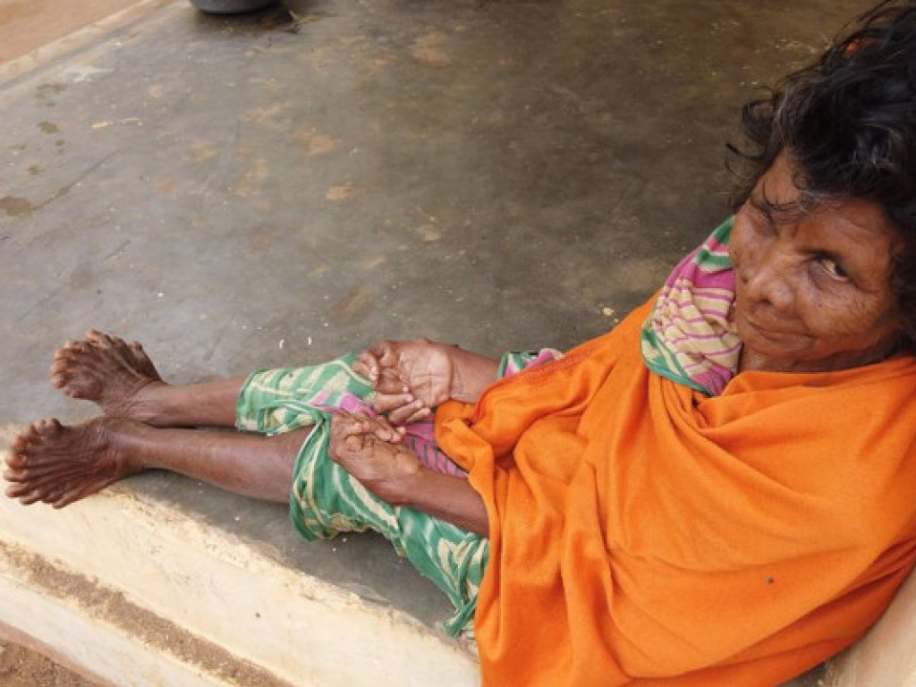 В Индии у «ведьмы» на руках и ногах насчитали 31 палец (ФОТО)