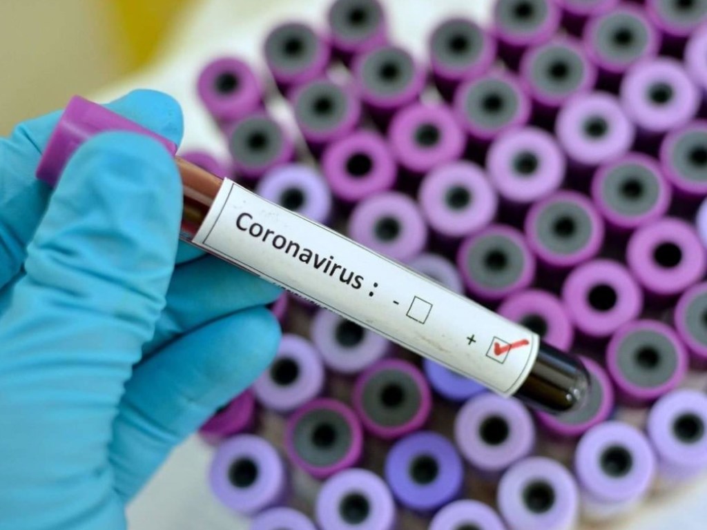 Украина получила тест-систему для диагностики нового коронавируса – Минздрав