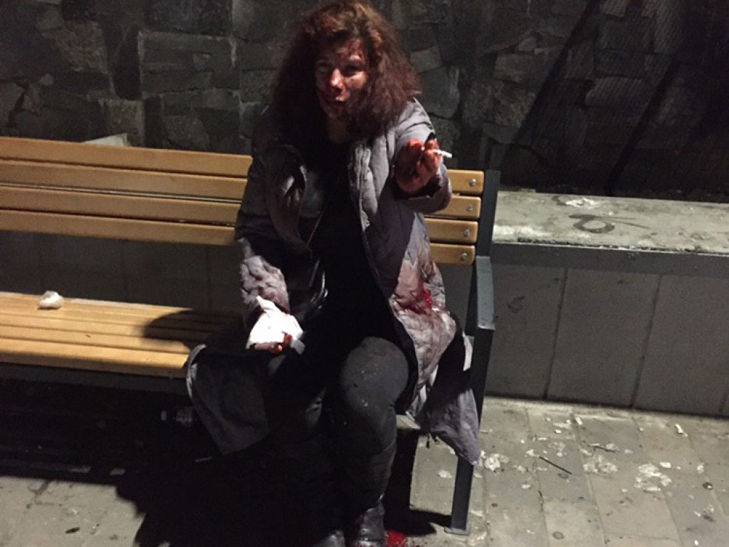 Сломан нос и выбиты зубы: на Троещине в Киеве жестоко избили пьяную женщину (ФОТО)