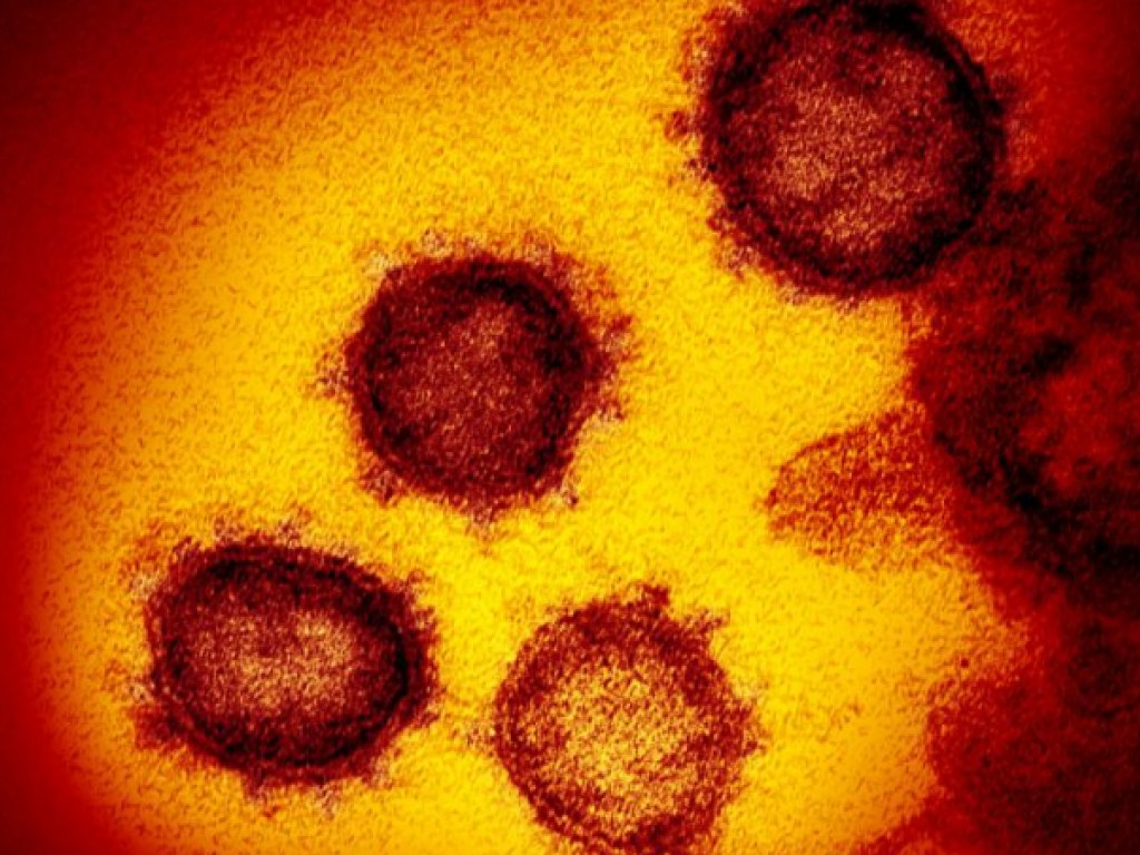 В США удалось сфотографировать коронавирус