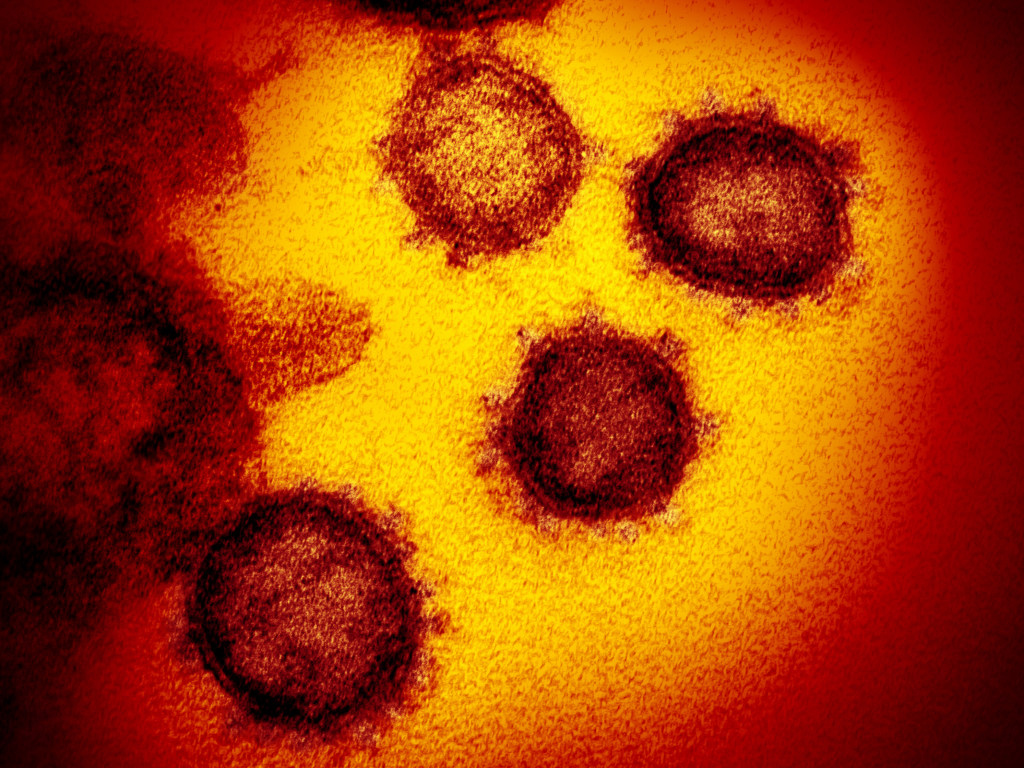 Эксперты оценили последствия коронавируса для мировой экономики