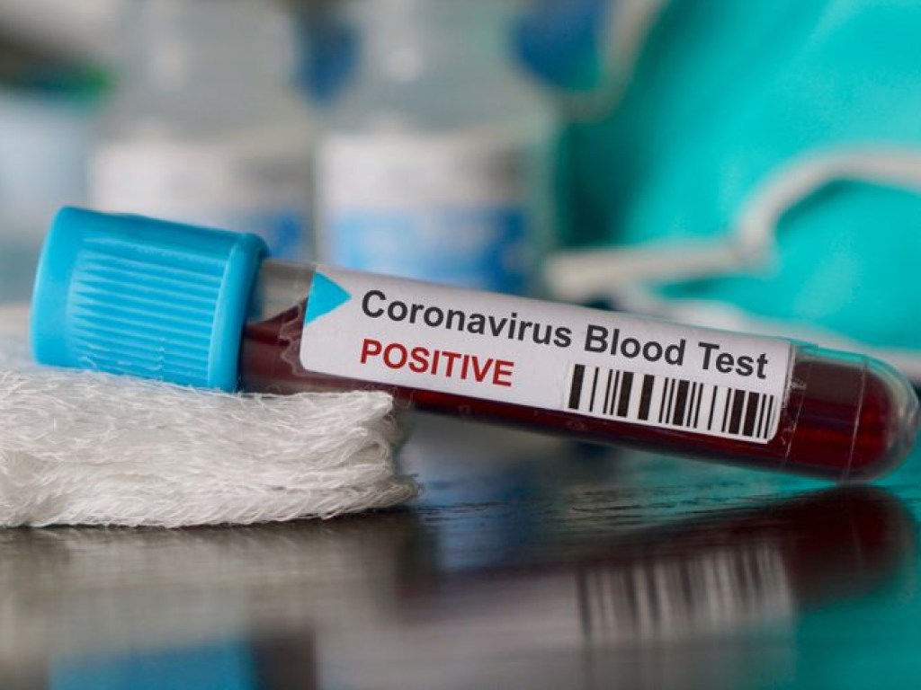 Борьба против коронавируса доказала жизнеспособность ЕС – европейский аналитик