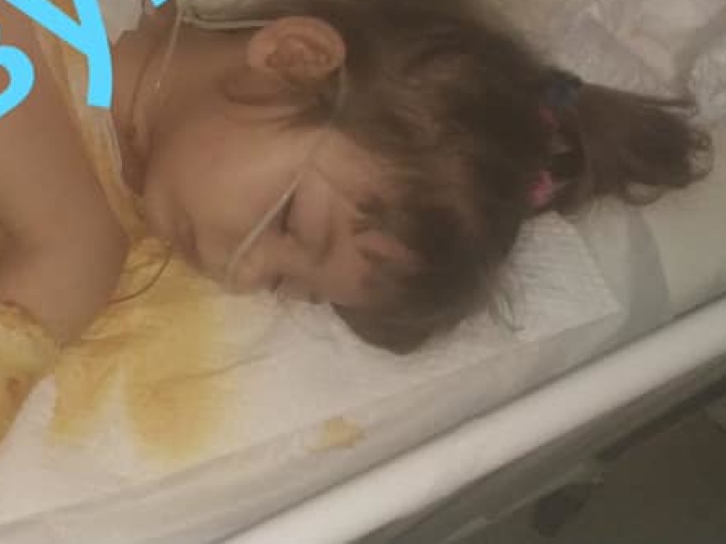 В Днепре мальчик толкнул 3-летнюю сестру на ведро с кипятком: девочку госпитализировали (ФОТО)