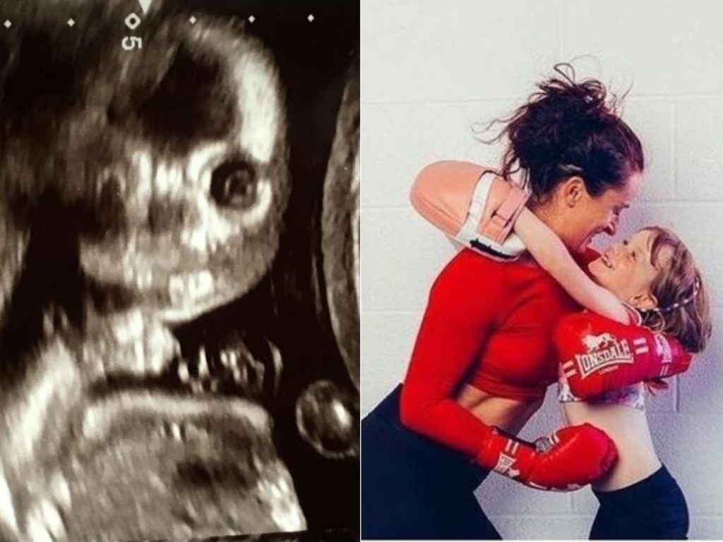 Не рождённый ребёнок смотрел прямо на неё: Снимок УЗИ вызвал шок у беременной девушки (ФОТО)