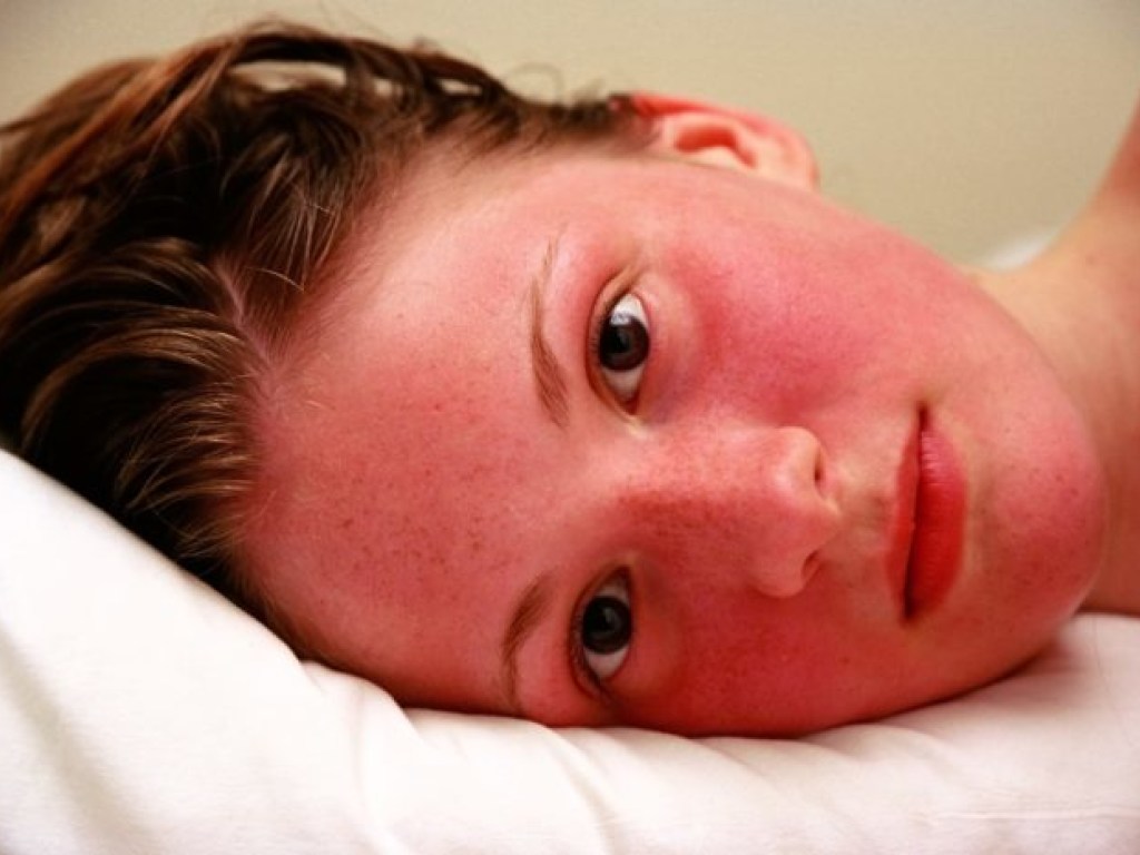 Медик: изменившийся цвет кожи лица может указывать на серьезные проблемы со здоровьем