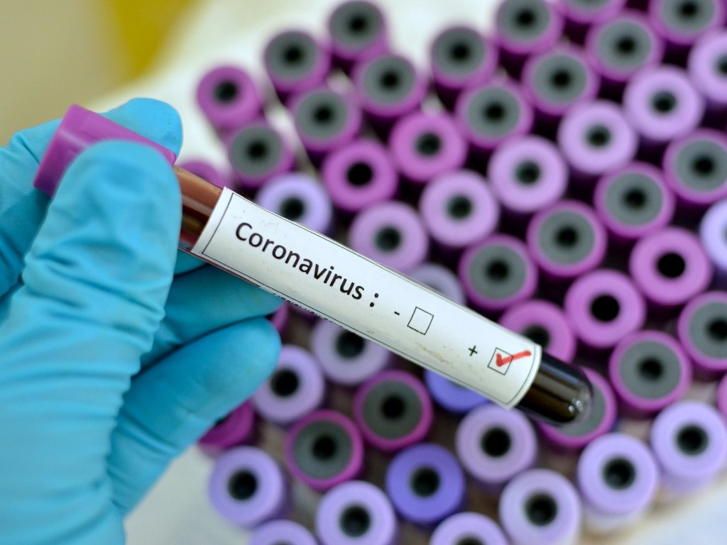 Минздрав: количество заболевших коронавирусом в Украине возросло