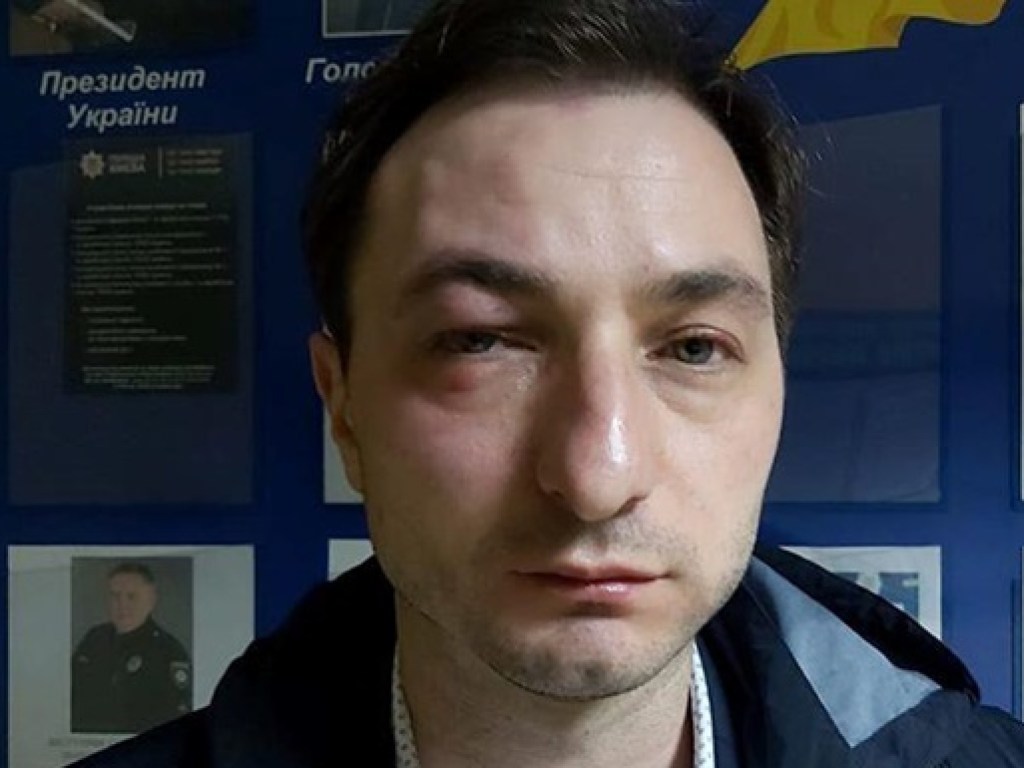 В Киеве неизвестные напали на главврача Национального института рака (ФОТО)