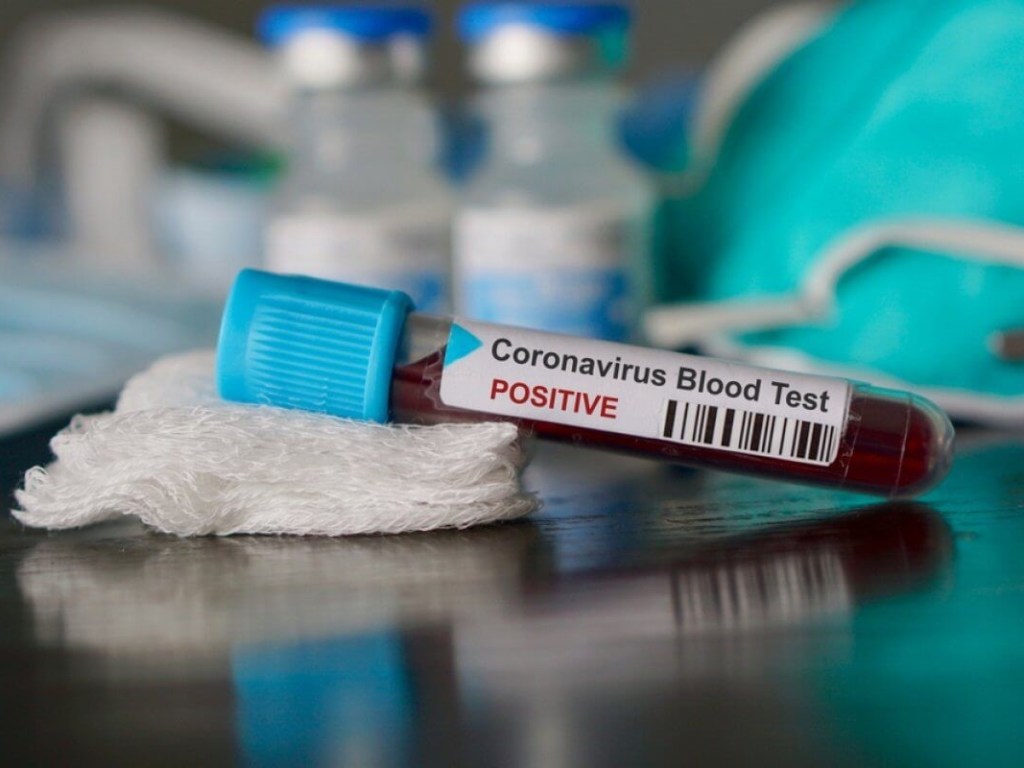 Из-за коронавируса в Украине нужно вводить чрезвычайное положение – эксперт