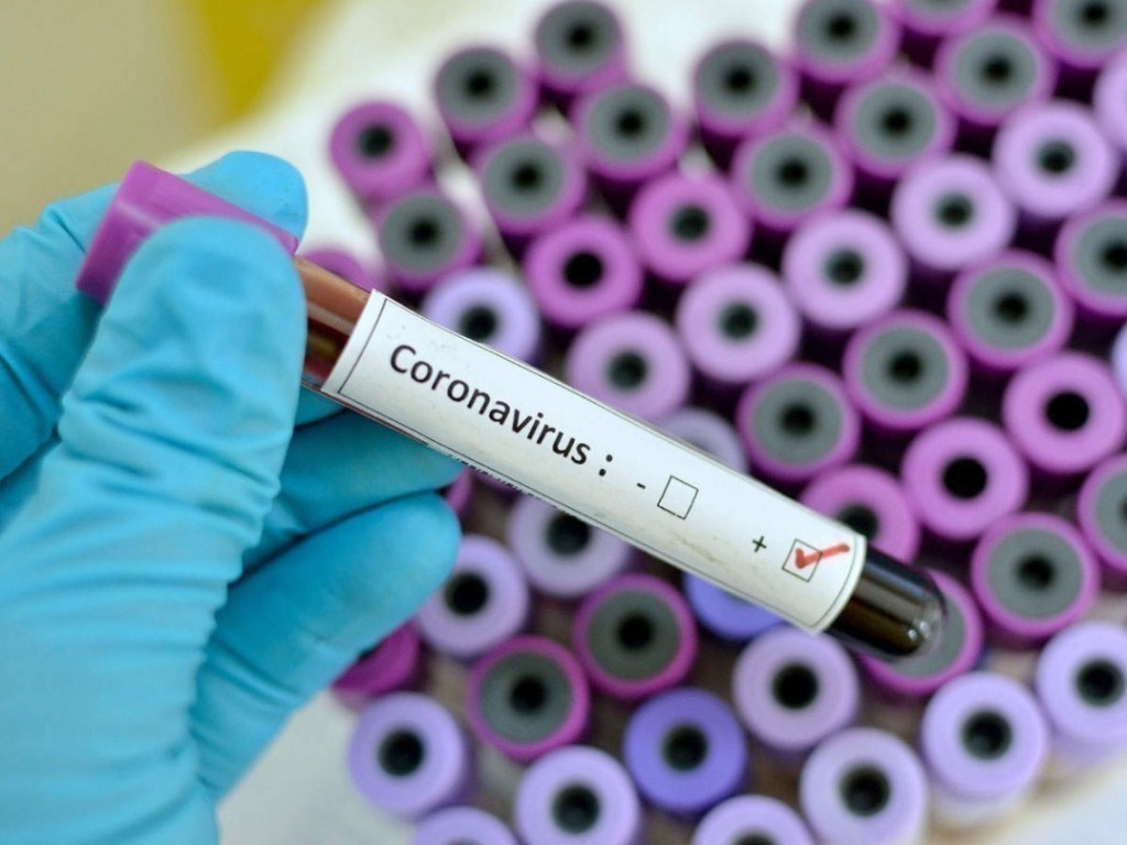 Больной коронавирусом в Житомире скрыл важную информацию: могут быть другие зараженные