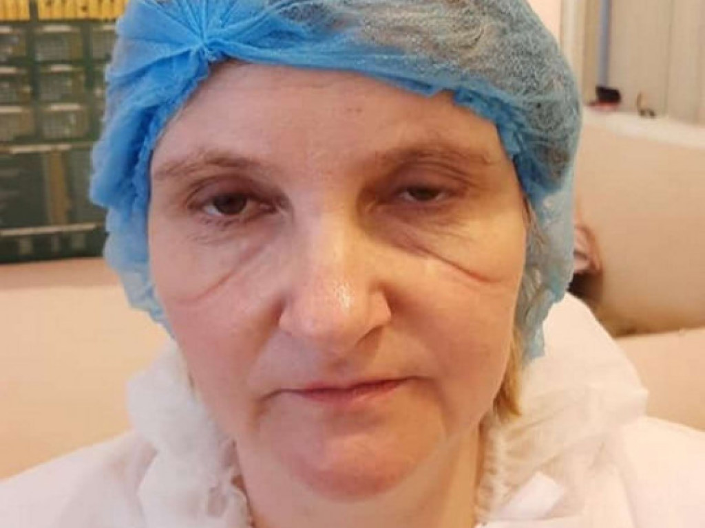 Фото измученной украинской реанимационной медсестры шокировало Сеть (ФОТО)