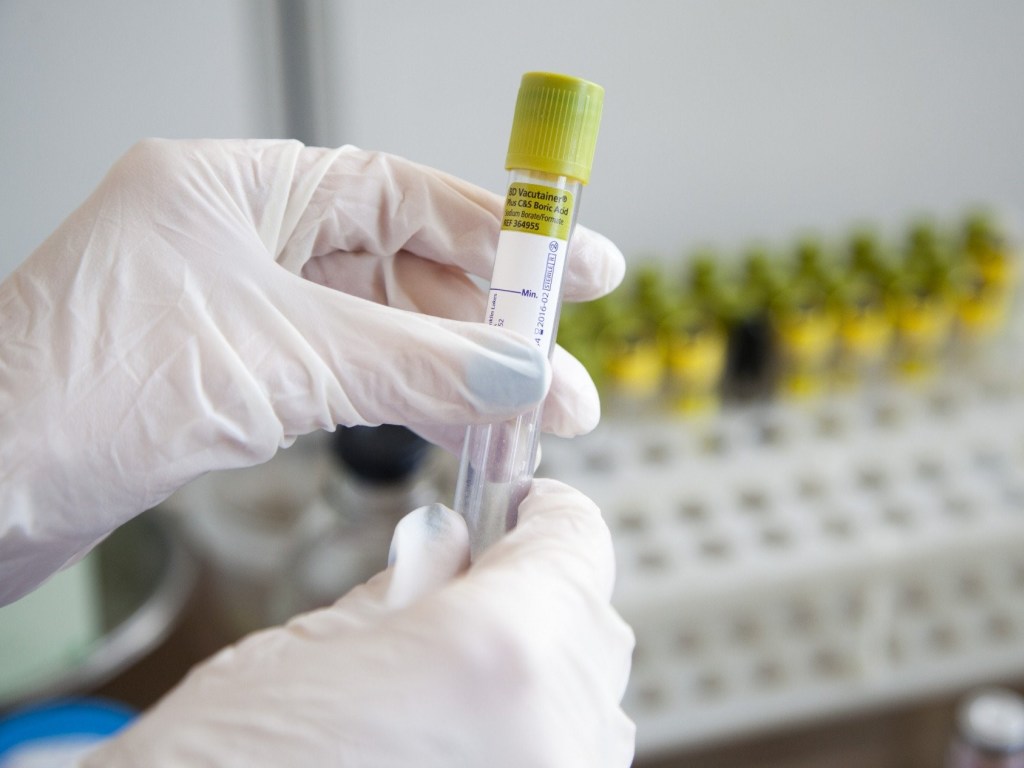 Врачи подсчитали, во сколько обходится лечение одного инфицированного коронавирусом в Украине