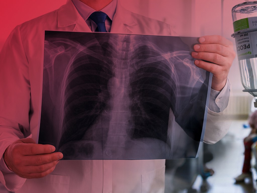 В Николаевской  области уволили 34 врача из больницы, где лечили пациентов с туберкулезом (ВИДЕО)