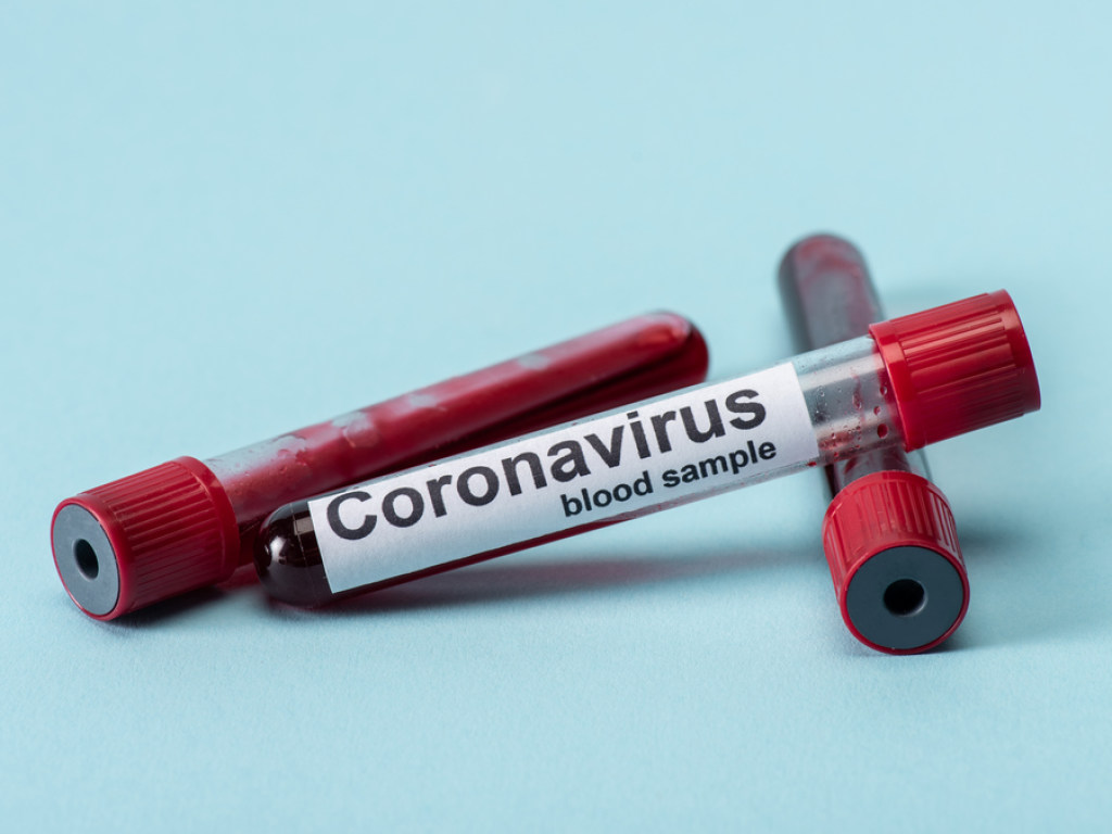 В Ужгороде семья диакона заразилась коронавирусом после того, как заболел 6-летний ребенок