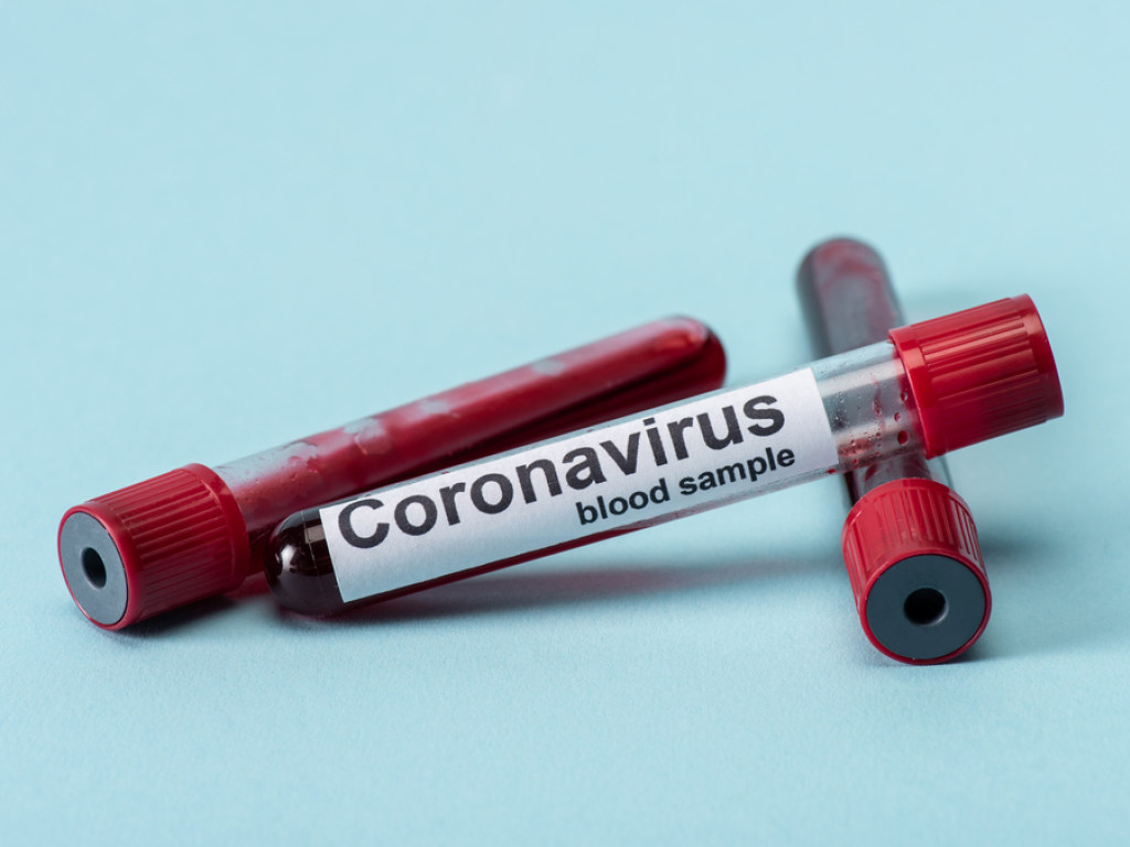 После отмены карантина может возникнуть новая волна коронавируса – врач