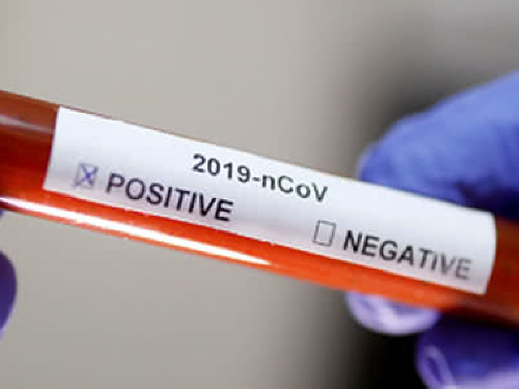 В Европе нет единого протокола по типированию причин смертности от коронавируса – эксперт
