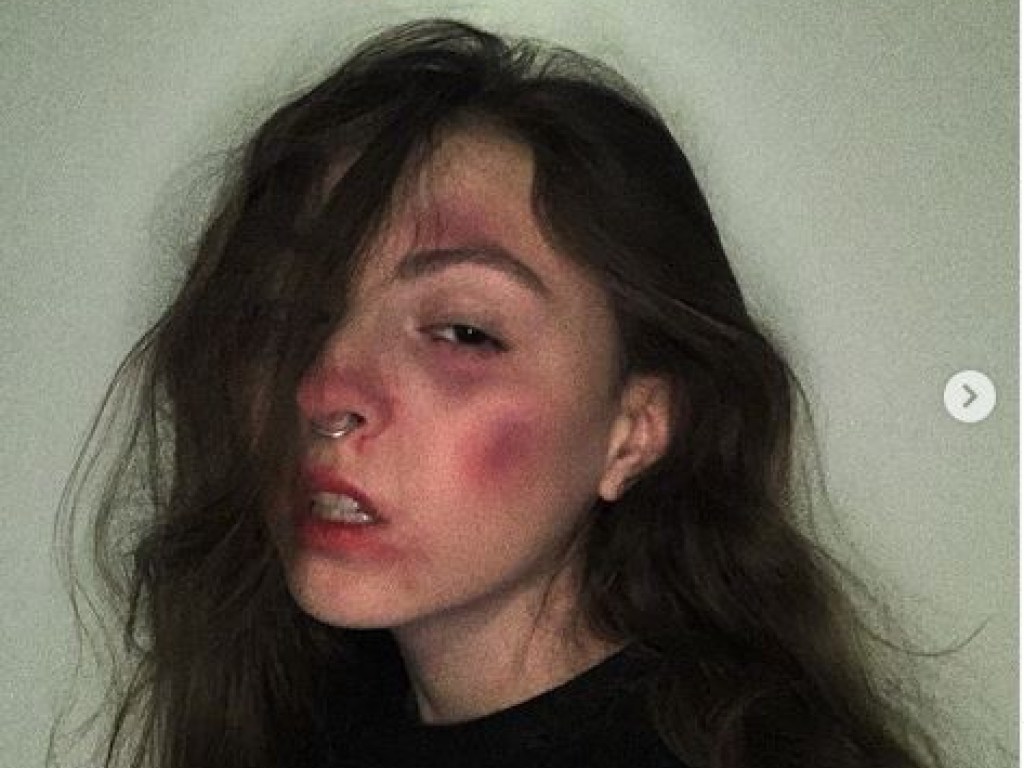 «Как вы относитесь к современным трендам?»: дочь Поляковой ужаснула «синяками» на лице (ФОТО)