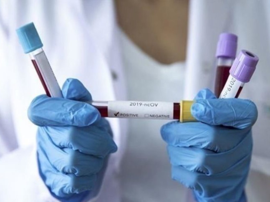 В Минздраве рассказали, как распределили тесты на коронавирус по регионам (ФОТО)