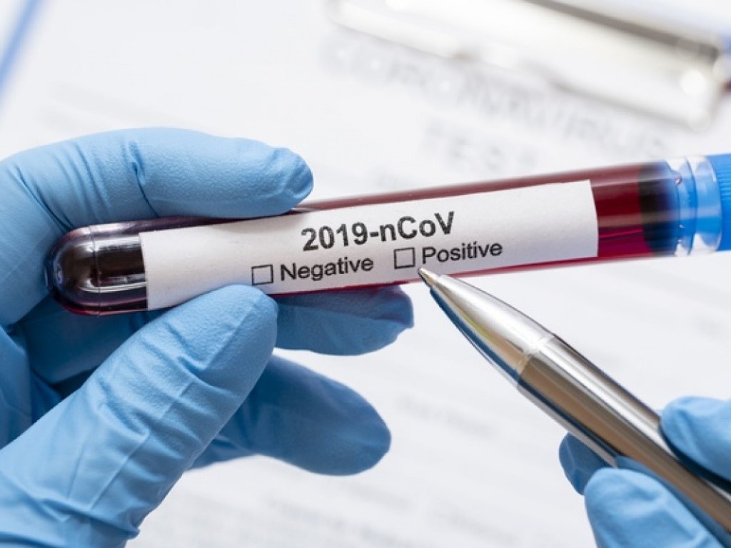 Экономная реформа и медицинский дефолт: Сколько стоит лечение COVID-19 и сколько может дать на это украинский бюджет?