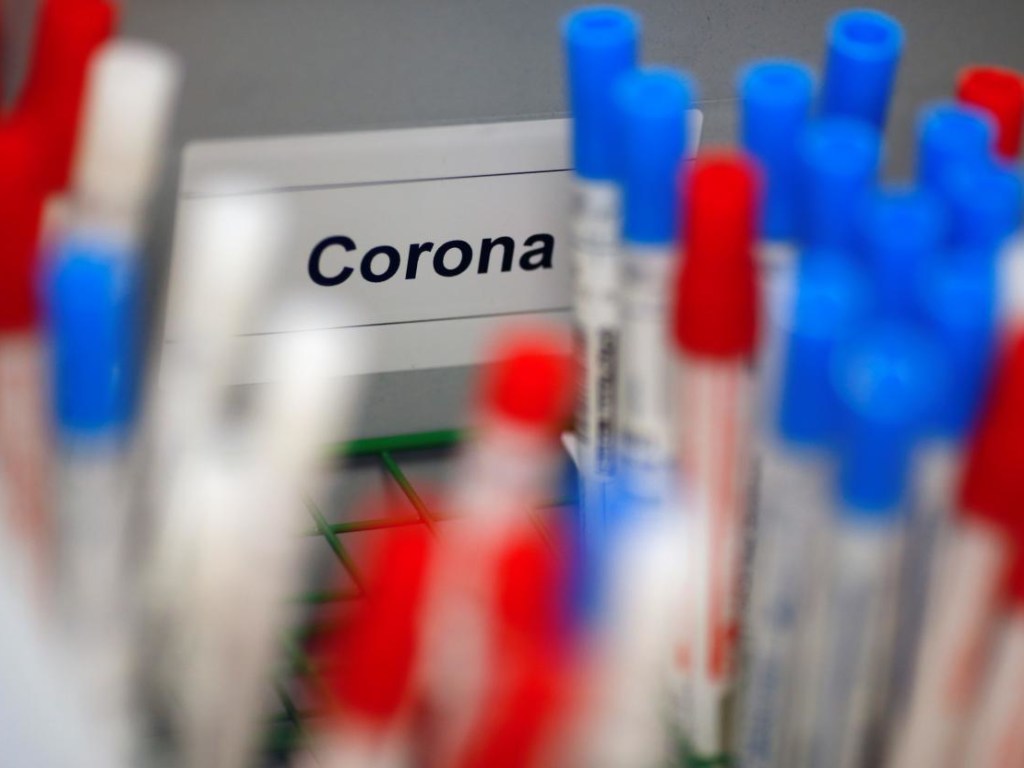 В Украине коронавирус будут выявлять с помощью ИФА-тестов