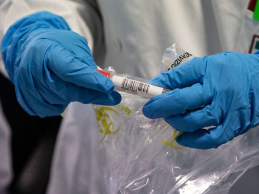 В Днепре от коронавируса скончался 57-летний мужчина с пневмонией