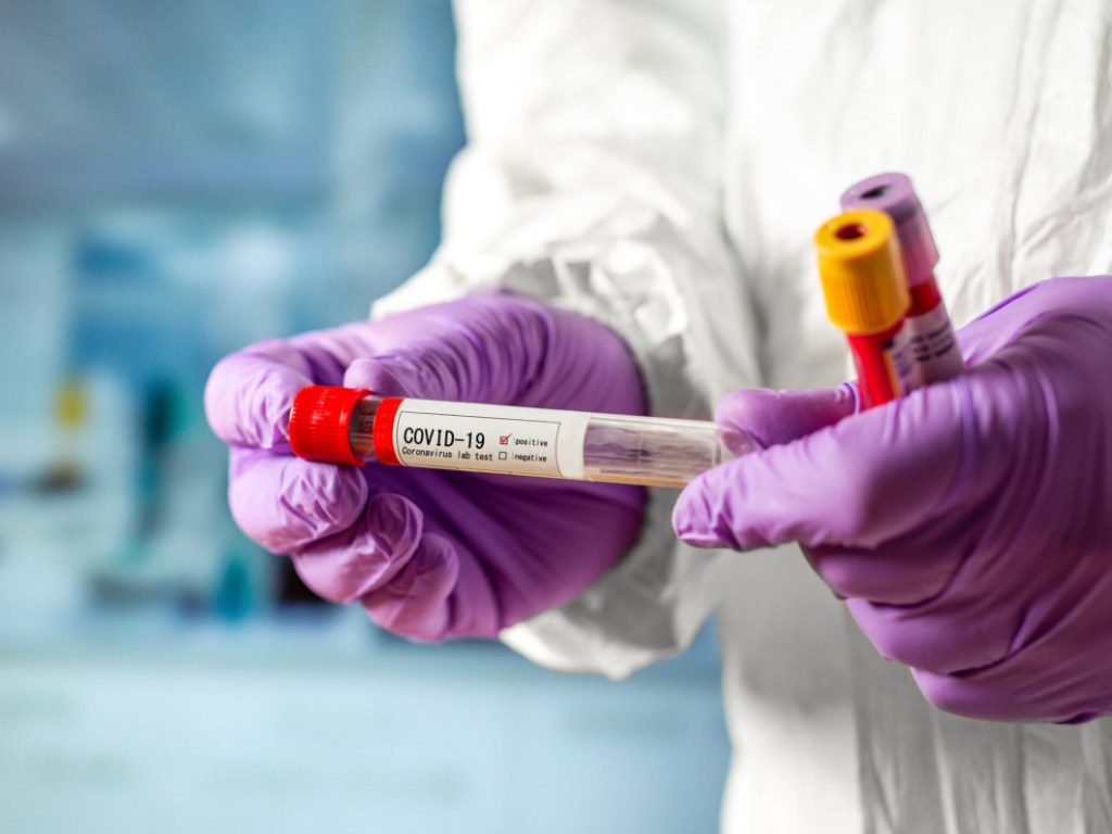 Украинский ученый спрогнозировал количество больных коронавирусом к началу 3 мая