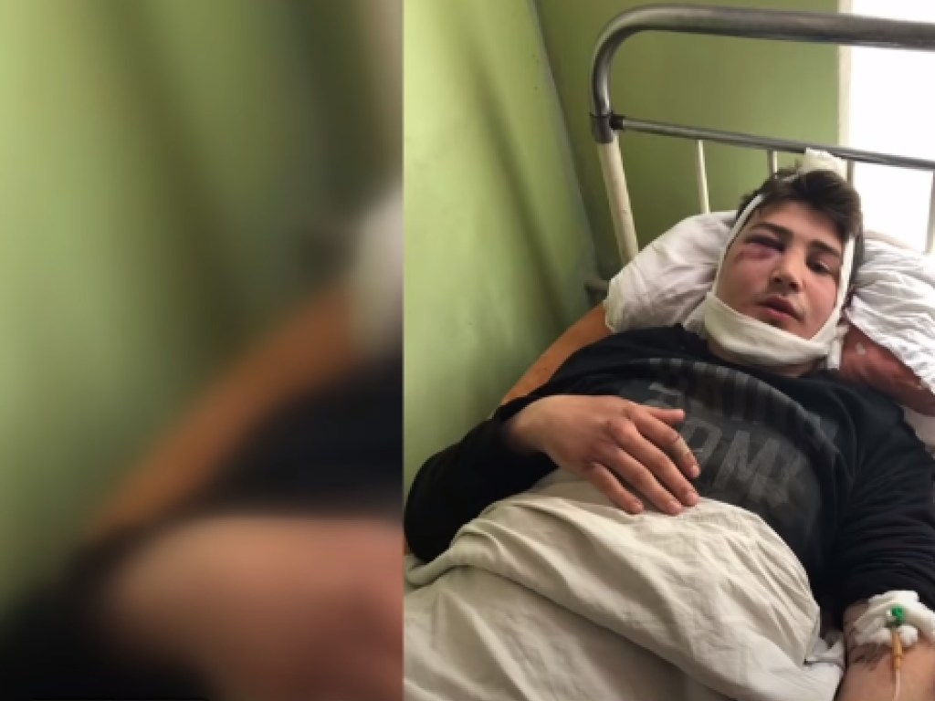 Угрожал пистолетом, сломал нос и челюсть: в Донецкой области экс-полицейский зверски избил подростка (ФОТО, ВИДЕО)