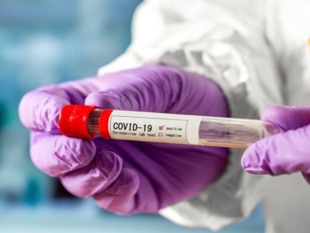 В Украине за сутки зафиксировали еще 455 случаев коронавируса