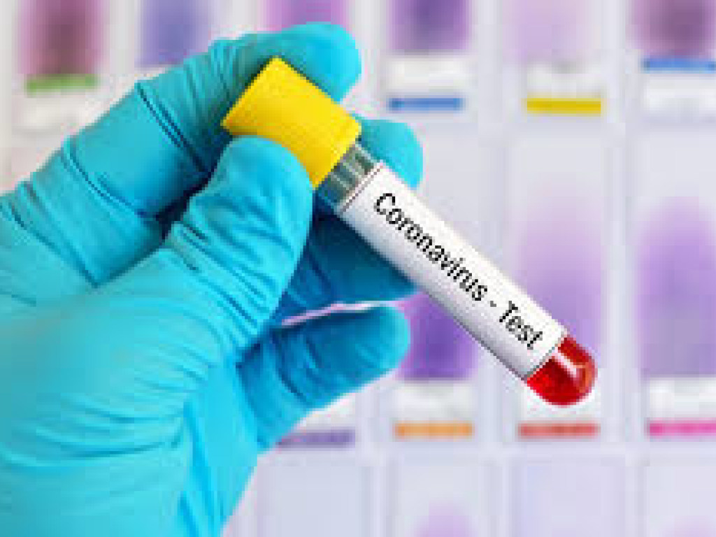 В Каховке после тестирования подтвердили 45 случаев коронавируса