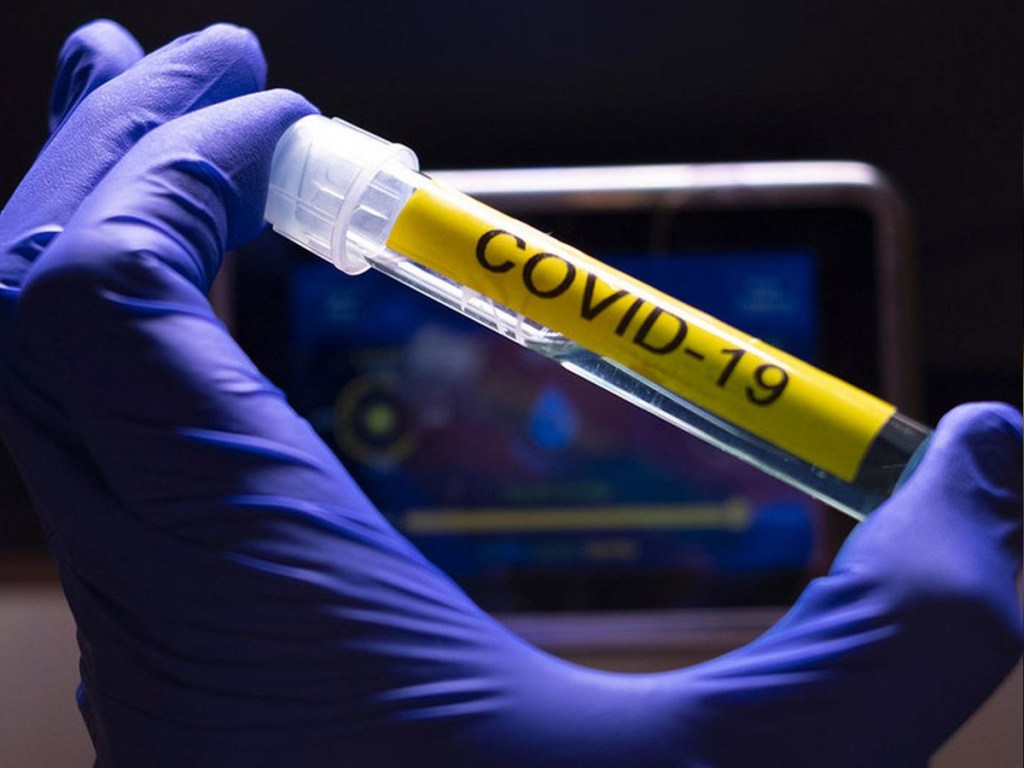 Минздрав: в Украине инфицирование коронавирусом пошло на спад