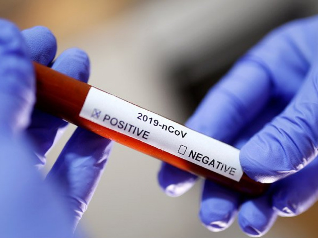 64-летняя жительница Днепра заразила десятки человек коронавирусом