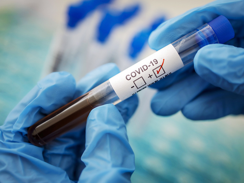 В Житомирской области лаборатория, которая тестирует на коронавирус, закрылась из-за перегрузки